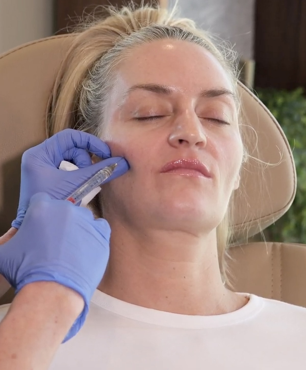 Woman receiving facial treatment in a clinic.