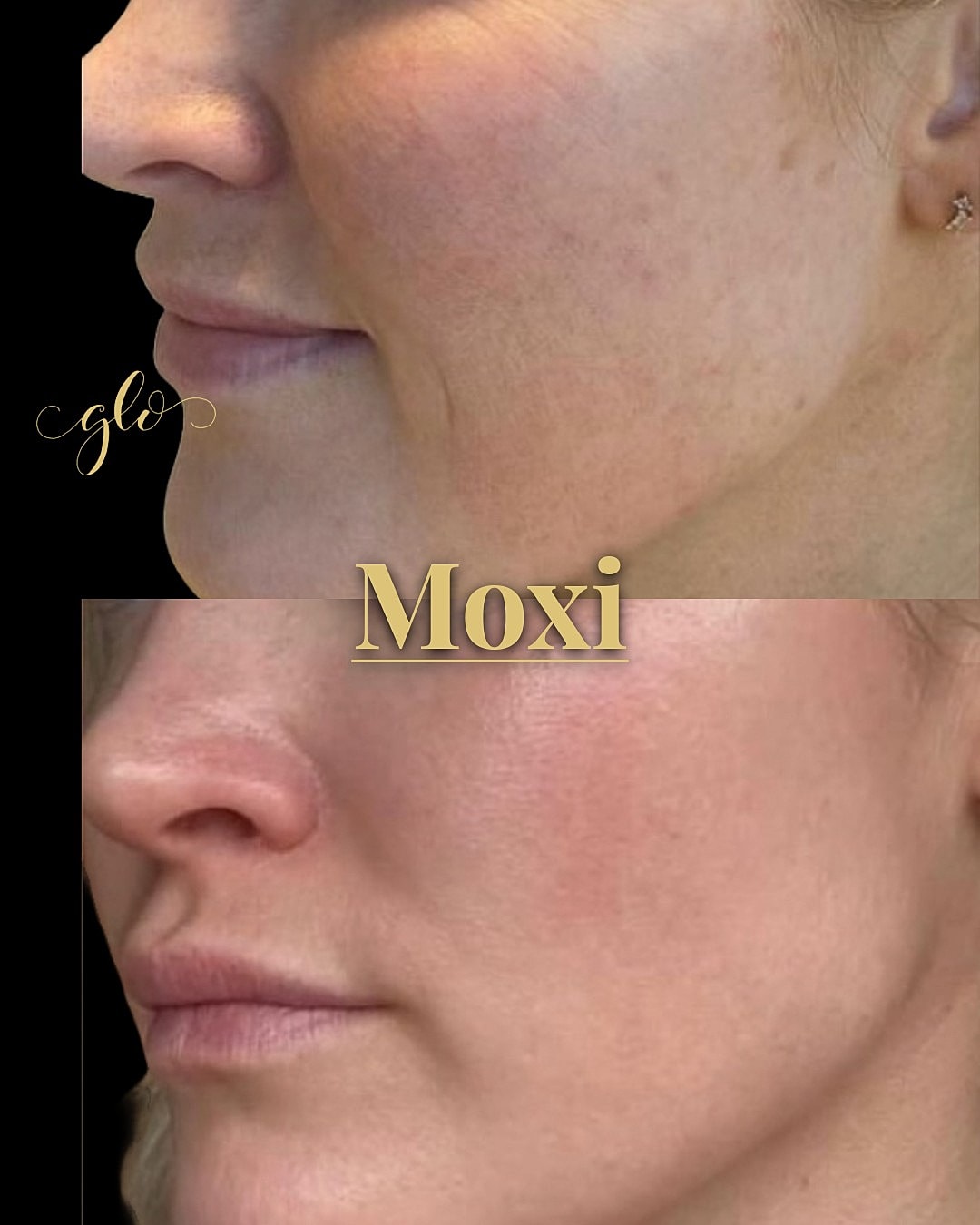 MOXI Gallery Before & After