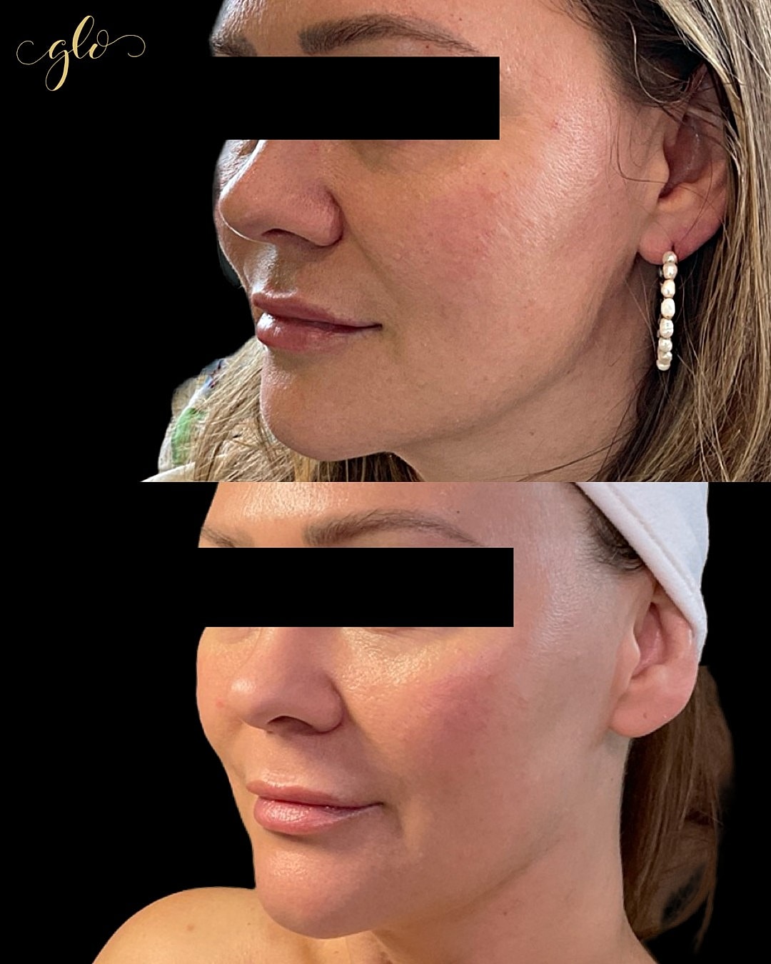 Glo Up Gallery Before & After