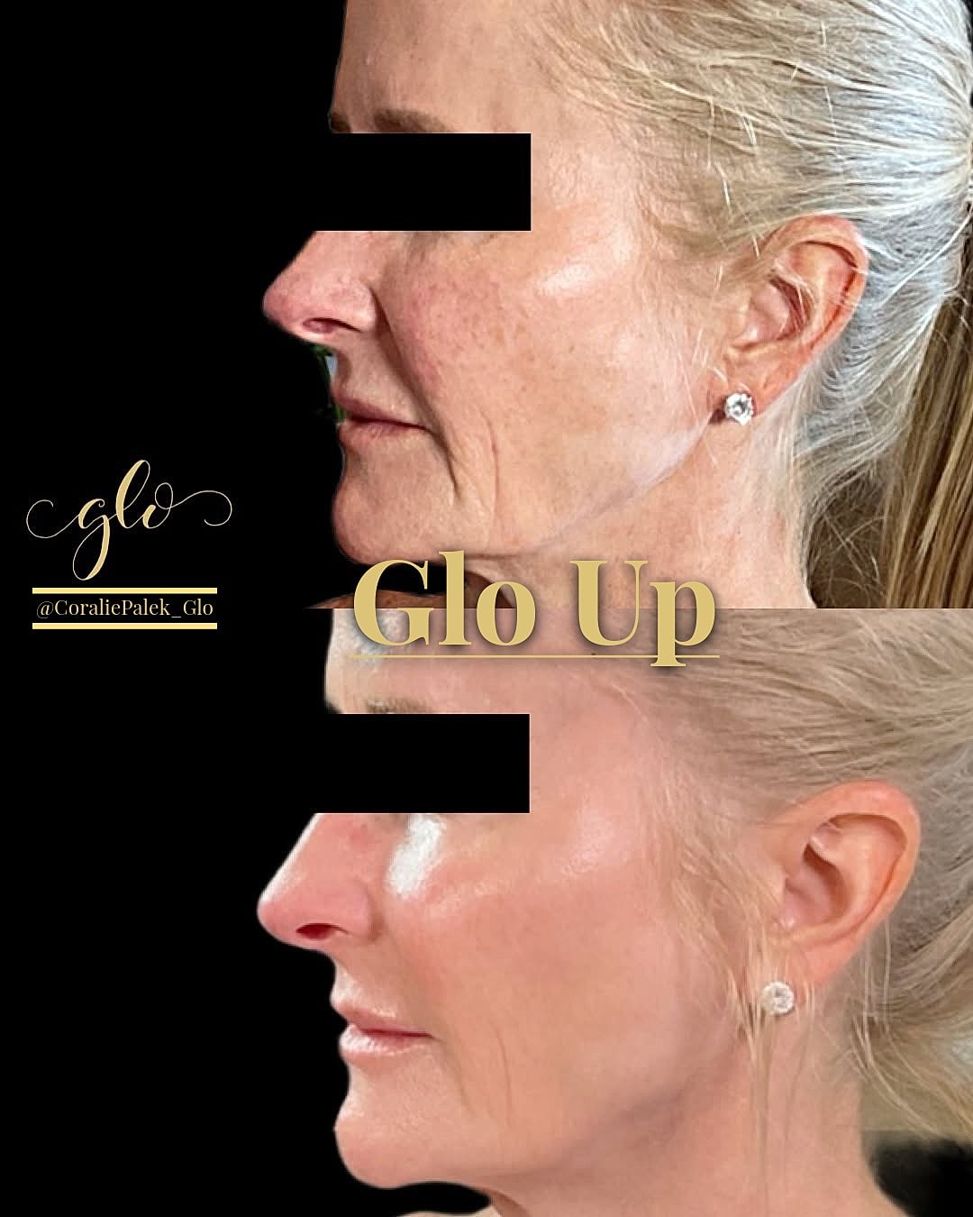 Glo Up Gallery Before & After