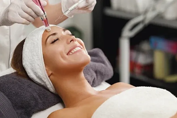 Top 3 Skin Concerns SkinPen Microneedling Can Help Improve